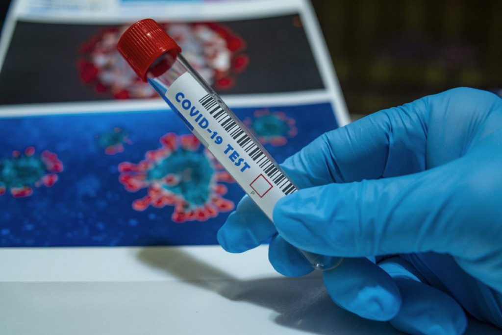 Medicinski centar Mursa – obavijest o mogućnosti cijepljenja i testiranja