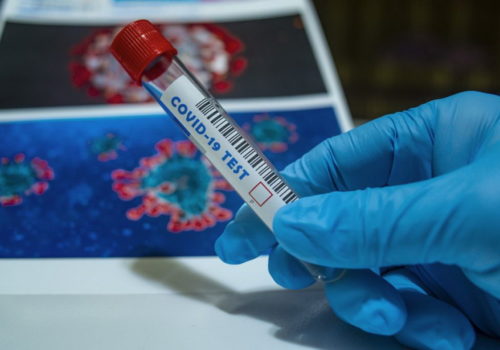 Medicinski centar Mursa – obavijest o mogućnosti cijepljenja i testiranja